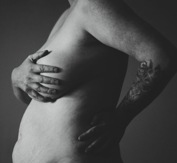 Abdomen (abdominoplastie)